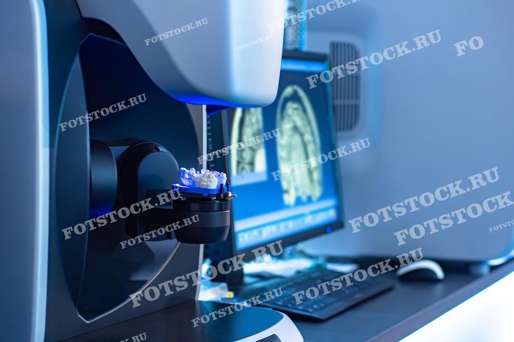 На изображении показано стоматологическое оборудование для 3D-сканирования зубов с использованием цифровых технологий. На заднем плане виден экран с результатами сканирования зубного ряда. Это оборудование используется для точной диагностики, планирования ортодонтического лечения или протезирования.