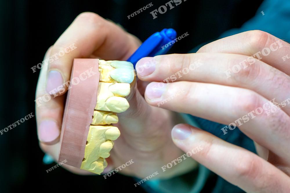Фотография демонстрирует процесс работы стоматолога с моделью зубов в стоматологической лаборатории. С помощью инструмента специалист воссоздает или модифицирует зубной протез для пациента. Это важный этап в стоматологическом протезировании.